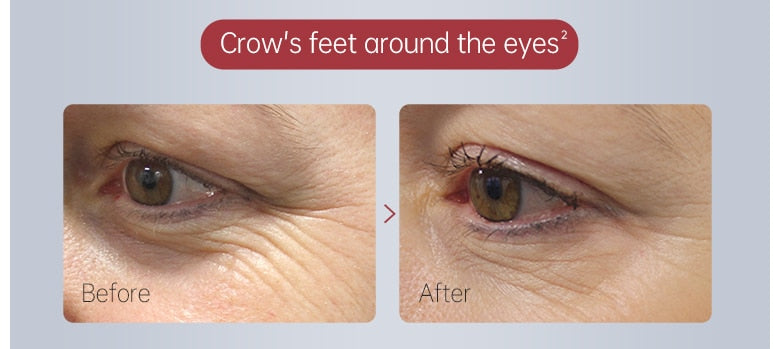 Anti Dark Circle Cream Eye Beauty Health