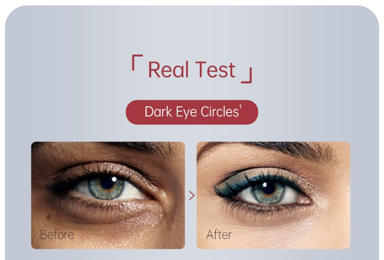 Anti Dark Circle Cream Eye Beauty Health