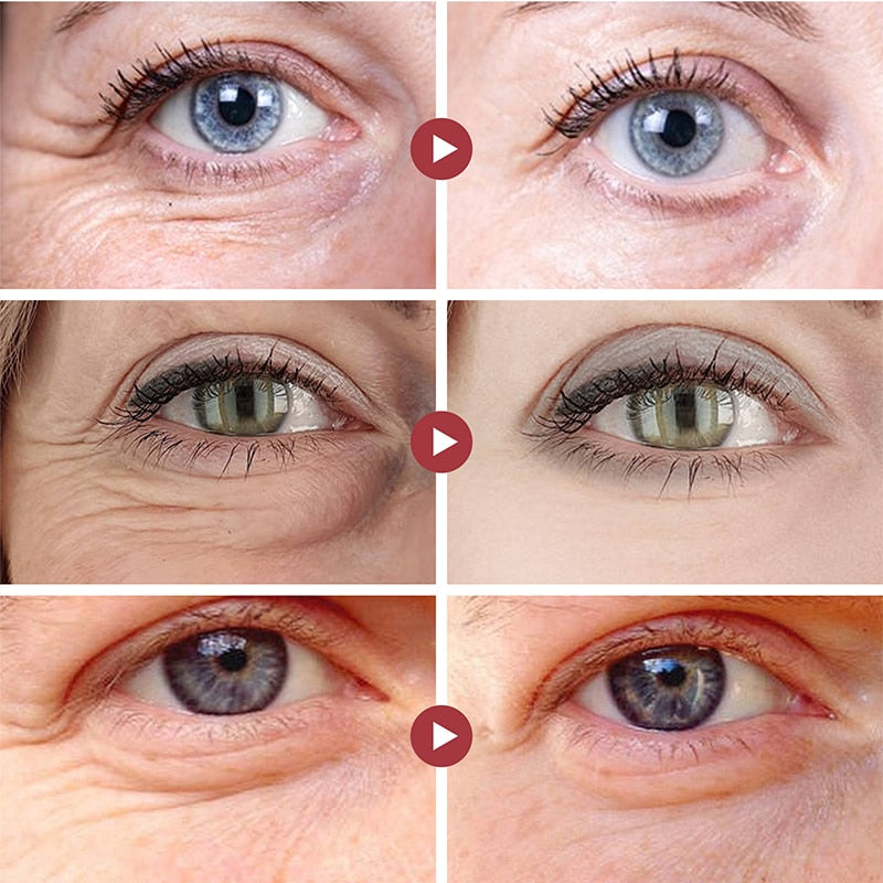 Anti Dark Circle Cream Eye Beauty Health