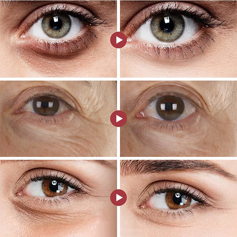Anti Dark Circle Cream Eye Beauty Health