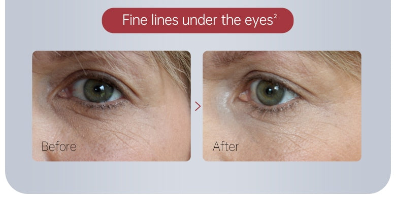 Anti Dark Circle Cream Eye Beauty Health